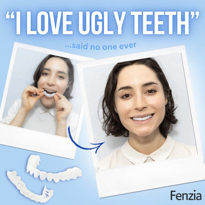 Fenzia | Snap On Veneer Teeth